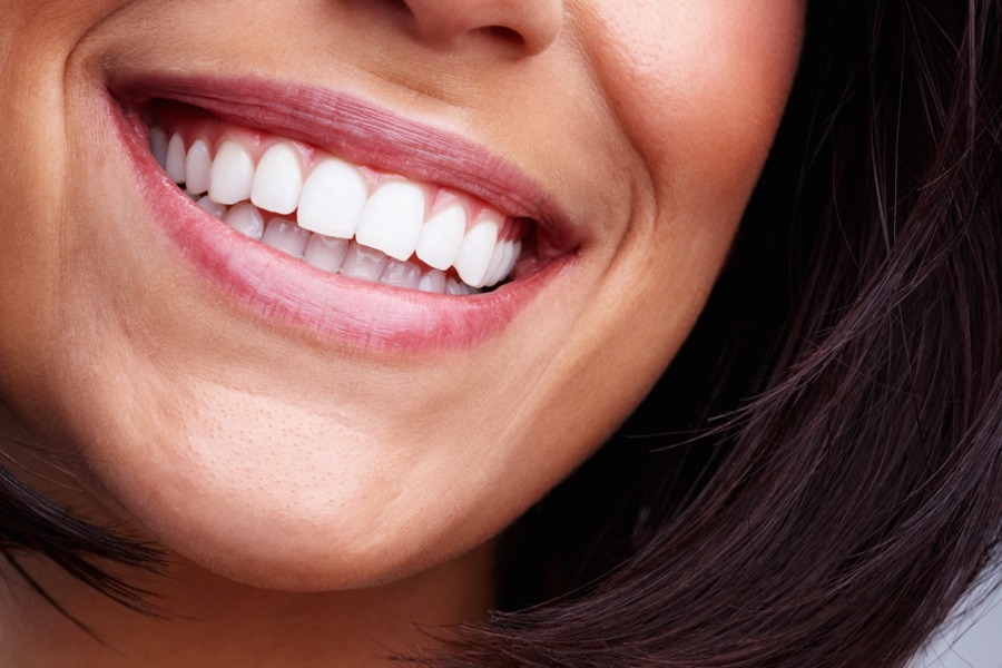 Riverside smile makeover patient with a confident bright smile